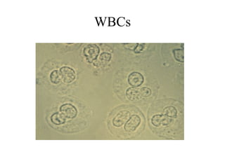 WBCs
 