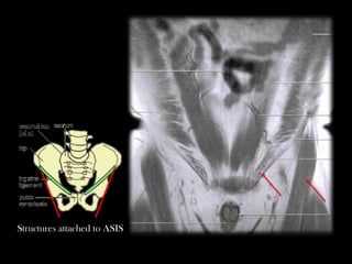 Radiliogical anatomy of the Pelvis .pptx