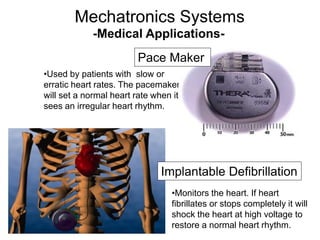 -Medical Applications-
•Used by patients with slow or
erratic heart rates. The pacemaker
will set a normal heart rate when it
sees an irregular heart rhythm.
•Monitors the heart. If heart
fibrillates or stops completely it will
shock the heart at high voltage to
restore a normal heart rhythm.
Mechatronics Systems
Pace Maker
Implantable Defibrillation
 