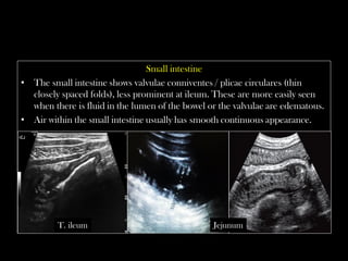 Valvulae Emergency Ultrasound Course -Lecture 03 -Introduction to bowel ...