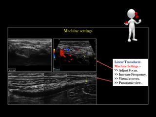 Appendix Transducer Emergency Ultrasound Course -Lecture 04 -Acute Appendicitis -Part 1 | PDF