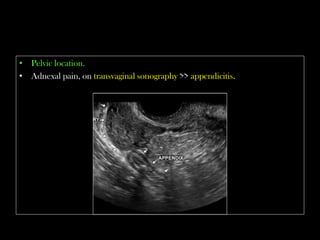 Emergency Ultrasound Course -Lecture 04 -Acute Appendicitis -Part 2 | PDF