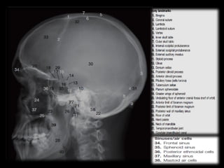 Uncus Radiopaedia Radiological anatomy of the brain 1.pptx