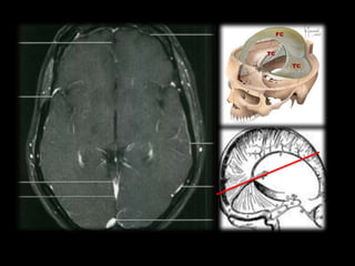 Radiological anatomy of the brain 1.pptx
