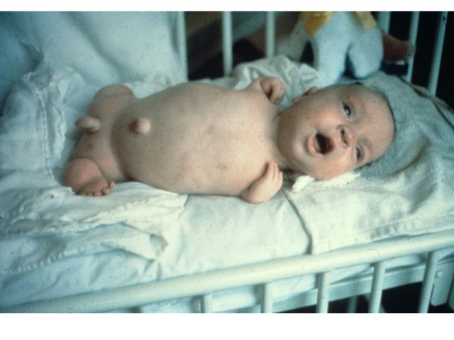 Generic accutane canada