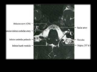 Cardunculus Brain Radiological anatomy of the brain2.pptx