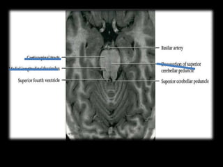 Cardunculus Brain Radiological anatomy of the brain2.pptx
