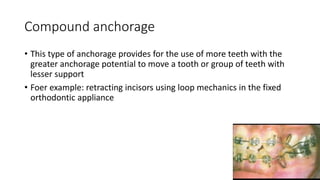 lecture_05_and_06-Anchorage_in_orthodontics[1].pptx