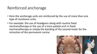 lecture_05_and_06-Anchorage_in_orthodontics[1].pptx