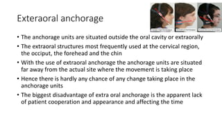 lecture_05_and_06-Anchorage_in_orthodontics[1].pptx