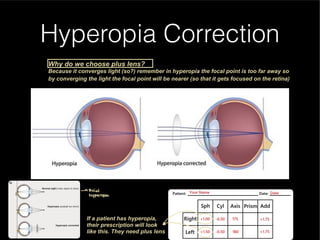 Understanding Normal and Abnormal Eye Vision and Refractive Errors | PDF
