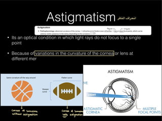 Understanding Normal and Abnormal Eye Vision and Refractive Errors | PDF