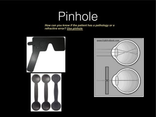 Pinhole Application Error Understanding Normal and Abnormal Eye Vision and Refractive Errors | PDF