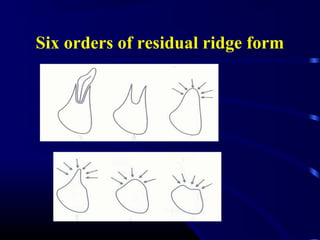 Sufficient Ridges Complete denture - Introduction to Prosthodontics | PPT