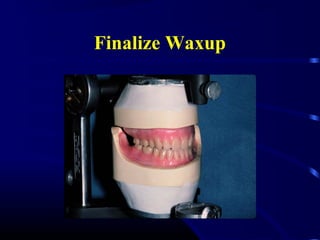 Finalize Waxup
 