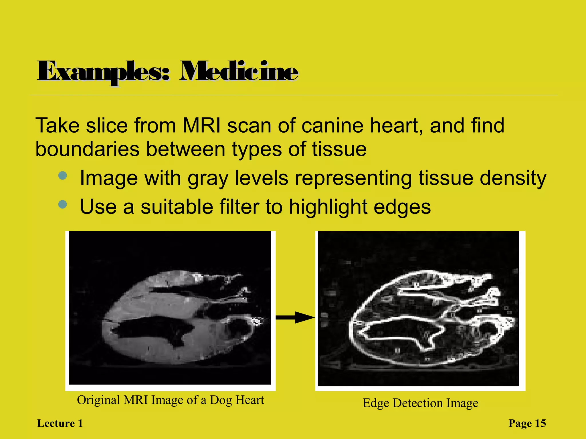 Examples: MedicineExamples: Medicine
Take slice from MRI scan of canine heart, and find
boundaries between types of tissue
 Image with gray levels representing tissue density
 Use a suitable filter to highlight edges
Original MRI Image of a Dog Heart Edge Detection Image
Lecture 1 Page 15
 