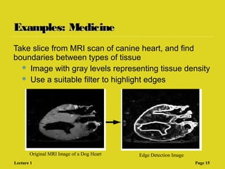 Examples: MedicineExamples: Medicine
Take slice from MRI scan of canine heart, and find
boundaries between types of tissue
 Image with gray levels representing tissue density
 Use a suitable filter to highlight edges
Original MRI Image of a Dog Heart Edge Detection Image
Lecture 1 Page 15
 