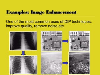 Examples: Image EnhancementExamples: Image Enhancement
One of the most common uses of DIP techniques:
improve quality, remove noise etc
 