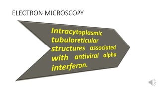 Kikuchi Microscope kikuchi disease | PPTX