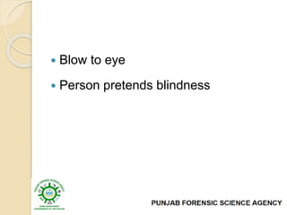  Blow to eye
 Person pretends blindness
 