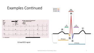 National Institute of Technology Calicut 7
Examples Continued
12 lead ECG signal
 