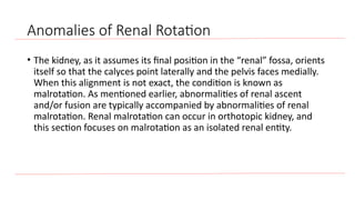Kidney Rotation Lecture 1. inro and anomalies.of the urinary system | PPTX