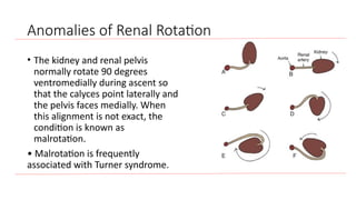 Kidney Rotation Lecture 1. inro and anomalies.of the urinary system | PPTX