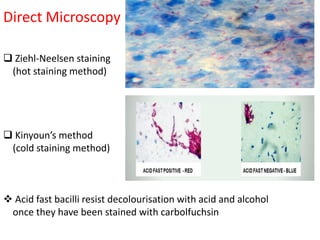 Direct Microscopy
❑ Ziehl-Neelsen staining
(hot staining method)
❑ Kinyoun’s method
(cold staining method)
❖ Acid fast bacilli resist decolourisation with acid and alcohol
once they have been stained with carbolfuchsin
 