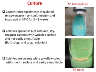 Culture
❑ Concentrated specimen is inoculated
on Lowenstein – Jensen’s medium and
incubated at 370C for 2 – 8 weeks
❑ Colonies appear as buff coloured, dry,
irregular colonies with wrinkled surface
and not easily emulsifiable
(Buff, rough and tough colonies)
❑ Colonies are creamy white to yellow colour
with smooth surface and easily emulsifiable
M. bovis
M. tuberculosis
 