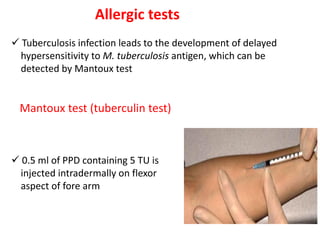Allergic tests
✓ Tuberculosis infection leads to the development of delayed
hypersensitivity to M. tuberculosis antigen, which can be
detected by Mantoux test
Mantoux test (tuberculin test)
✓ 0.5 ml of PPD containing 5 TU is
injected intradermally on flexor
aspect of fore arm
 