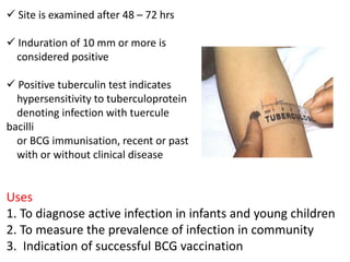 ✓ Site is examined after 48 – 72 hrs
✓ Induration of 10 mm or more is
considered positive
✓ Positive tuberculin test indicates
hypersensitivity to tuberculoprotein
denoting infection with tuercule
bacilli
or BCG immunisation, recent or past
with or without clinical disease
Uses
1. To diagnose active infection in infants and young children
2. To measure the prevalence of infection in community
3. Indication of successful BCG vaccination
 