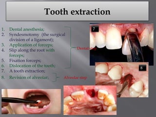 Comprehensive Overview of Dentistry: Examination, Caries, and Tooth ...