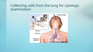 Collecting cells from the lung for cytologic
examination
 