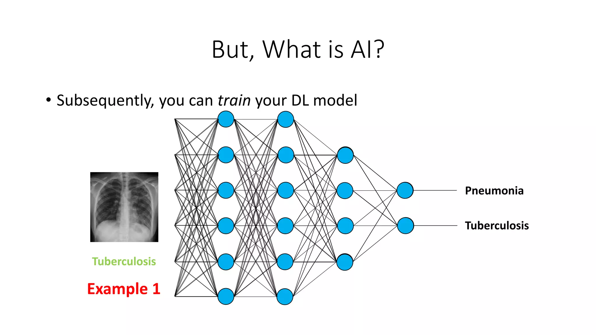 But, What is AI?
Tuberculosis
Pneumonia
Tuberculosis
Example 1
• Subsequently, you can train your DL model
 