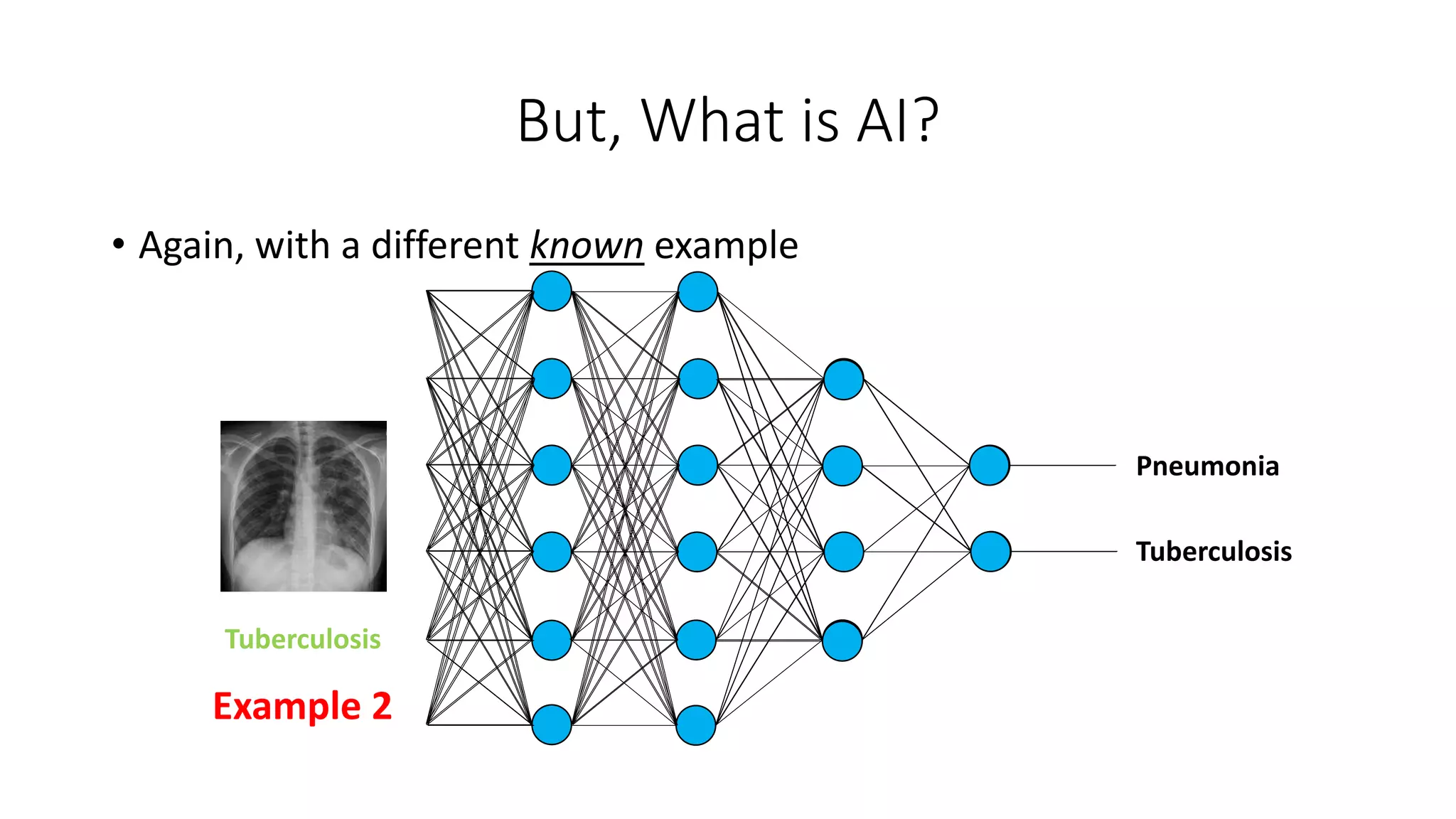 But, What is AI?
Tuberculosis
Pneumonia
Tuberculosis
Example 2
• Again, with a different known example
 