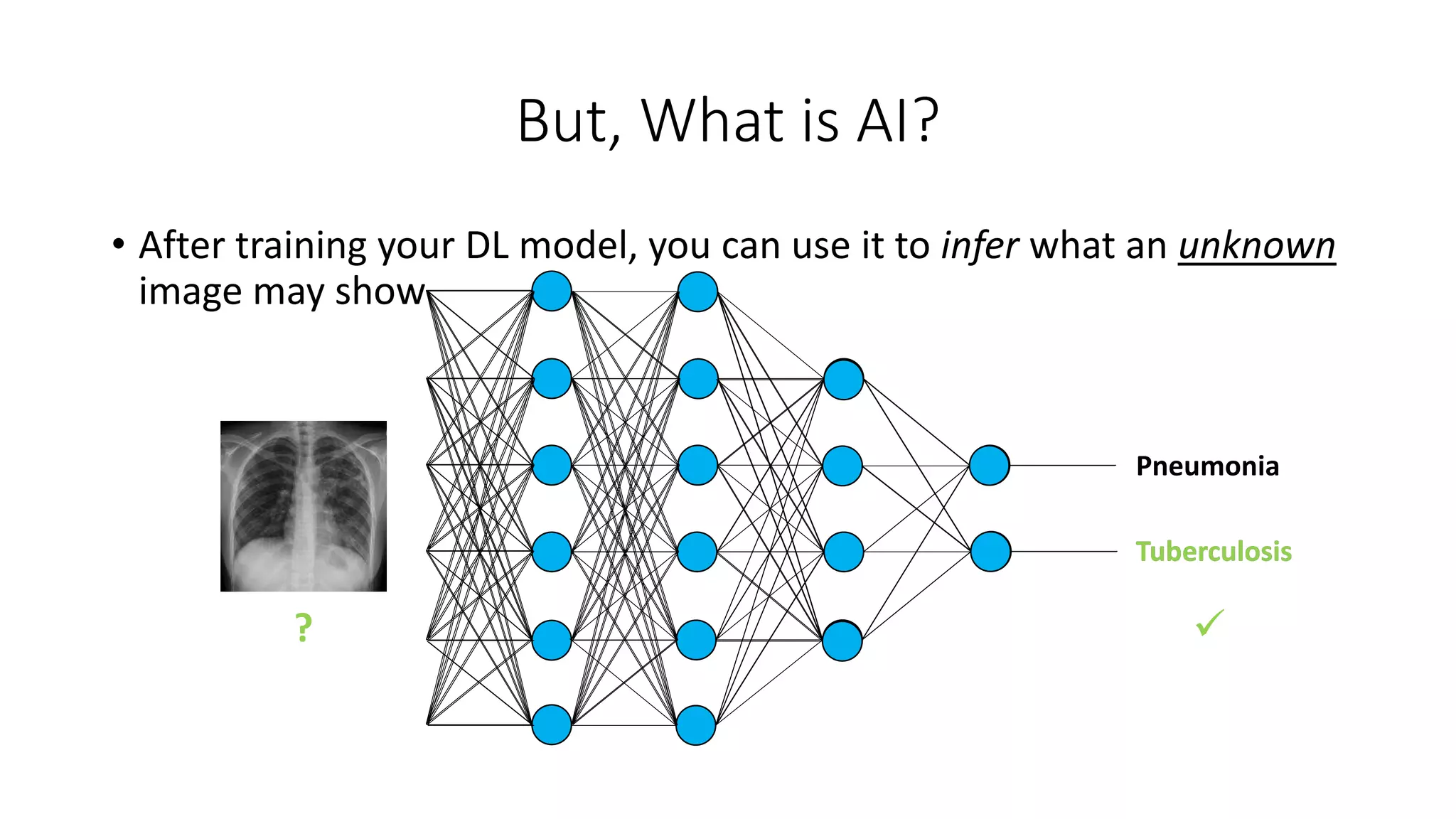 But, What is AI?
Tuberculosis
Pneumonia
?
• After training your DL model, you can use it to infer what an unknown
image may show
Tuberculosis

 