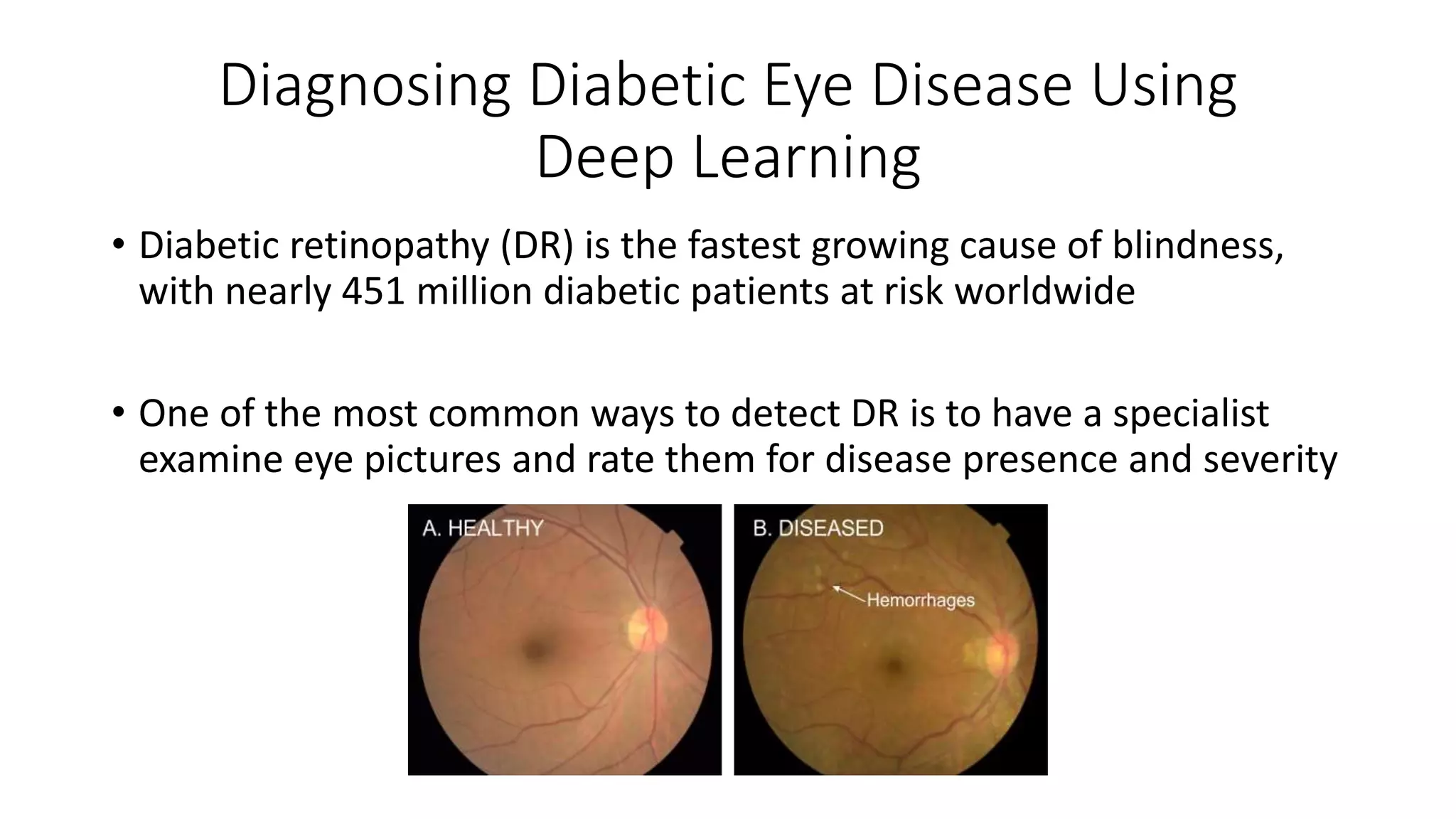 Diagnosing Diabetic Eye Disease Using
Deep Learning
• Diabetic retinopathy (DR) is the fastest growing cause of blindness,
with nearly 451 million diabetic patients at risk worldwide
• One of the most common ways to detect DR is to have a specialist
examine eye pictures and rate them for disease presence and severity
 