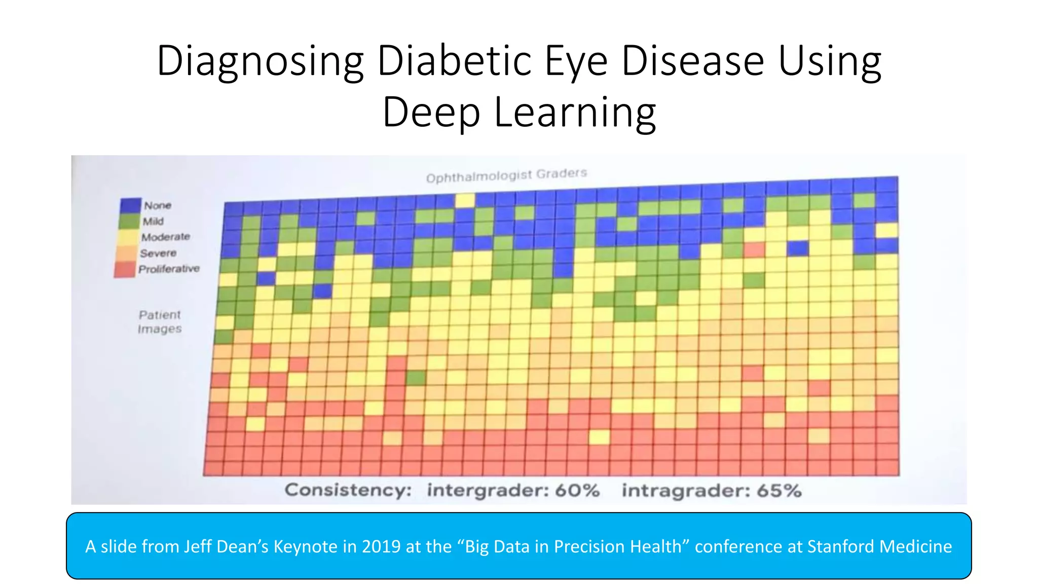 Diagnosing Diabetic Eye Disease Using
Deep Learning
A slide from Jeff Dean’s Keynote in 2019 at the “Big Data in Precision Health” conference at Stanford Medicine
 