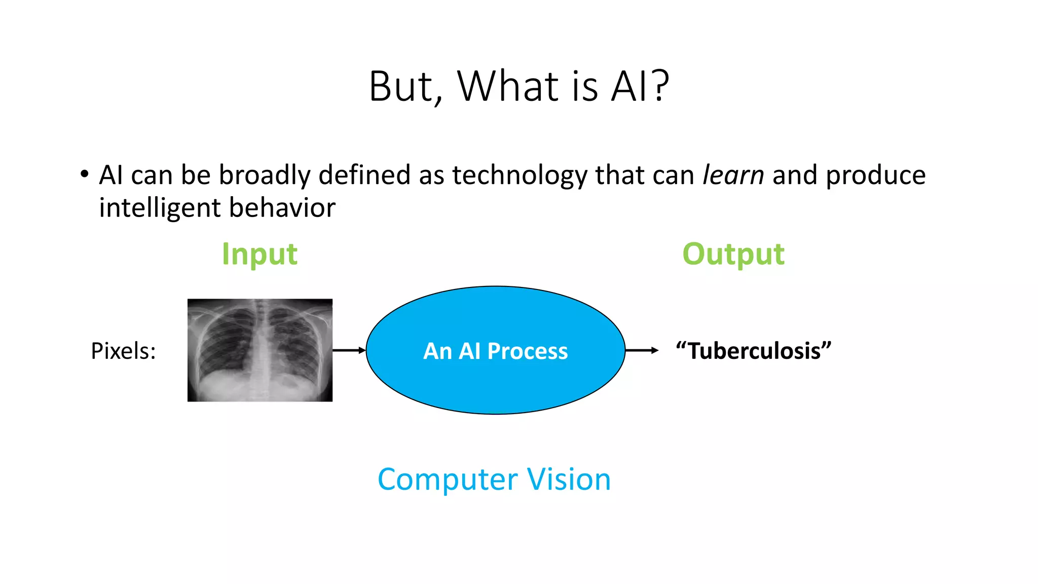 But, What is AI?
• AI can be broadly defined as technology that can learn and produce
intelligent behavior
Input Output
Pixels: “Tuberculosis”
An AI Process
Computer Vision
 