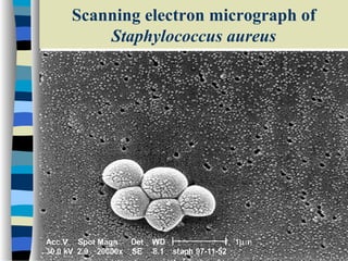 Scanning electron micrograph of
Staphylococcus aureus

 