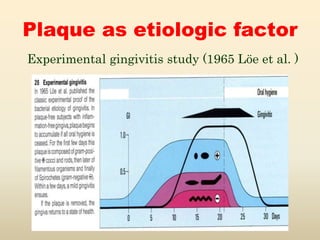 Plaque as etiologic factor
Experimental gingivitis study (1965 Löe et al. )
 