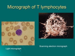 Micrograph of T lymphocytes  Light micrograph  Scanning electron micrograph  