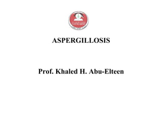 ASPERGILLOSIS
Prof. Khaled H. Abu-Elteen
 
