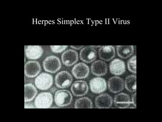Lecture 10- Viruses.ppt