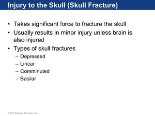 Skull Potential Injuries Lecture 10_M13_KARR120_10E_PPT_C13.ppt