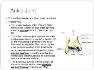 Tibia Ceiling Lecture_10_new-_Radiography_of_Lower_Limb_I.ppt