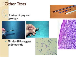 Other Tests
 Uterine biopsy and
cytology
 PMNs>18% suggest
endometritis
 