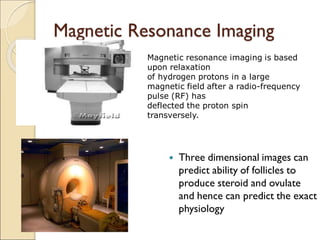 Magnetic Resonance Imaging
 Three dimensional images can
predict ability of follicles to
produce steroid and ovulate
and hence can predict the exact
physiology
Magnetic resonance imaging is based
upon relaxation
of hydrogen protons in a large
magnetic field after a radio-frequency
pulse (RF) has
deflected the proton spin
transversely.
 