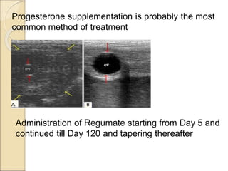 Progesterone supplementation is probably the most
common method of treatment
Administration of Regumate starting from Day 5 and
continued till Day 120 and tapering thereafter
 