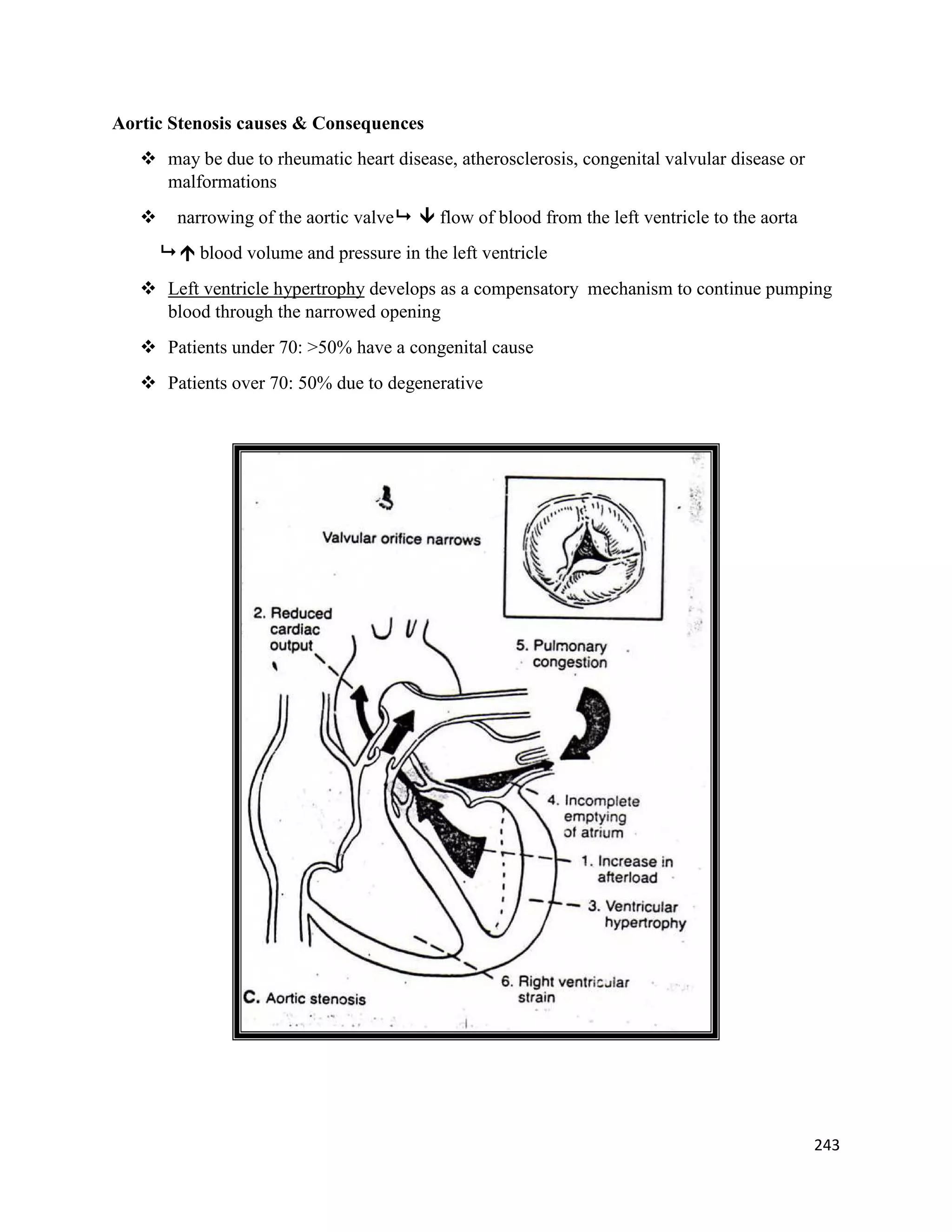 Aortic Stenosis causes & Consequences
 may be due to rheumatic heart disease, atherosclerosis, congenital valvular disease or
malformations
 narrowing of the aortic valve  flow of blood from the left ventricle to the aorta
  blood volume and pressure in the left ventricle
 Left ventricle hypertrophy develops as a compensatory mechanism to continue pumping
blood through the narrowed opening
 Patients under 70: >50% have a congenital cause
 Patients over 70: 50% due to degenerative
243
 